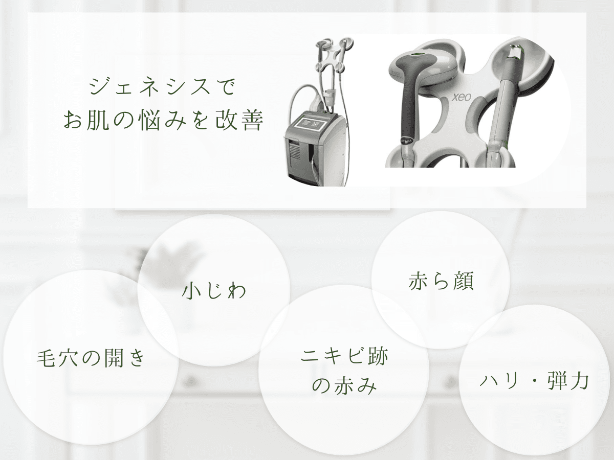 ジェネシスの紹介